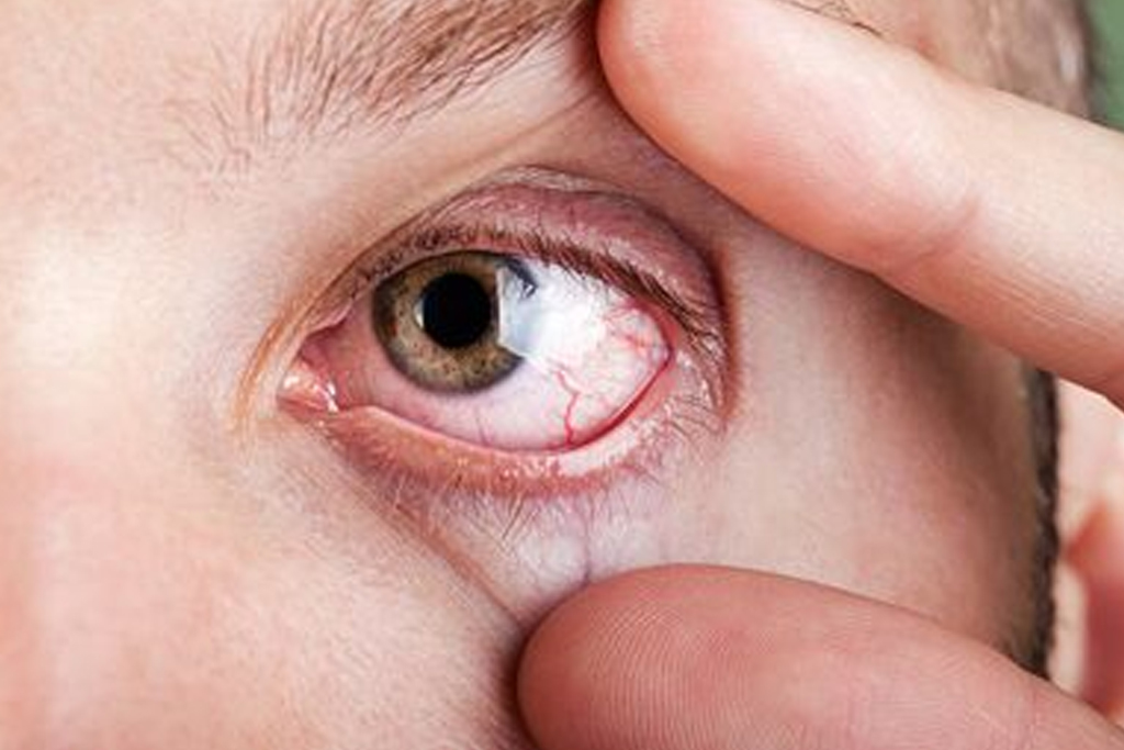 Eye Warning Signs You Should Never Ignore