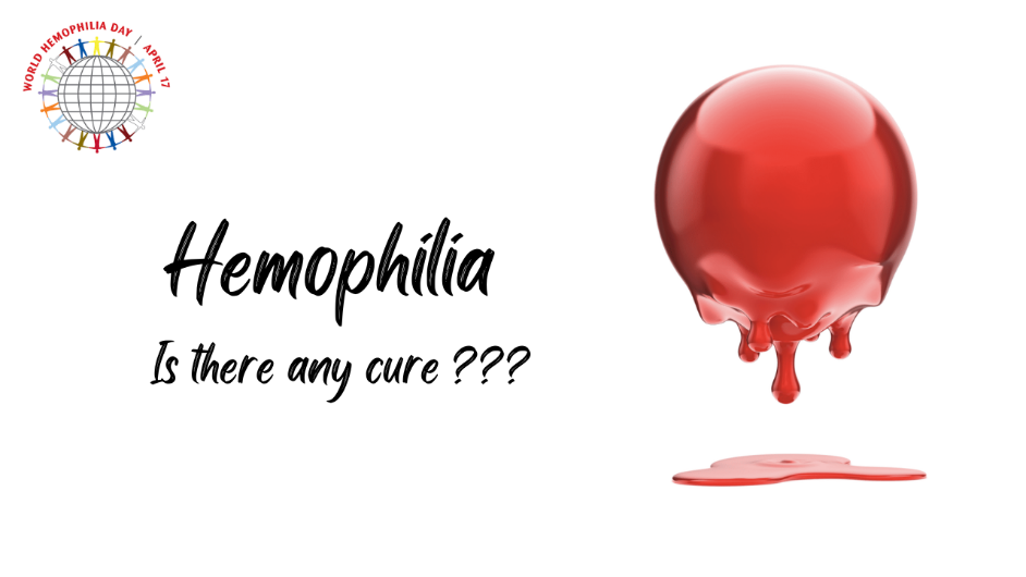 Hemophilia: Is there a cure or treatment for Hemophilia ?